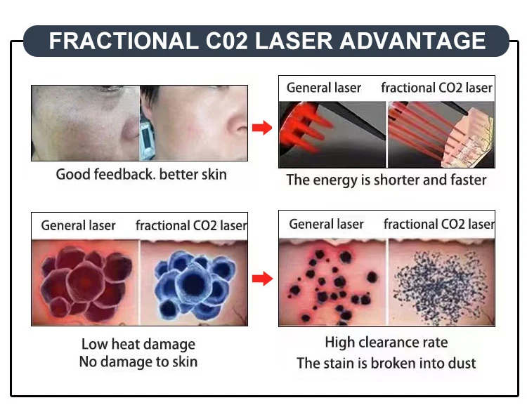 Co2 Fractional Laser Skin Resurfacing Fractional Co2 Laser With Rf Wrinkles Acne Scar Removal Machine