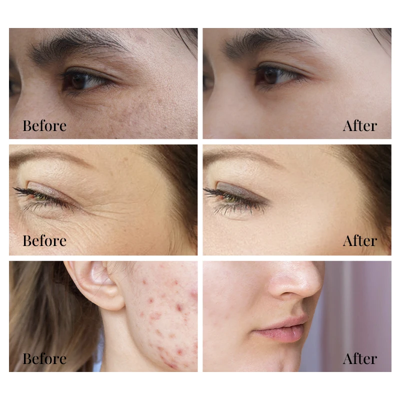 Private Label Hydrating Collagen Moisturizing Facial Skin Niacinamide Hyaluronic Acid Serum For Face