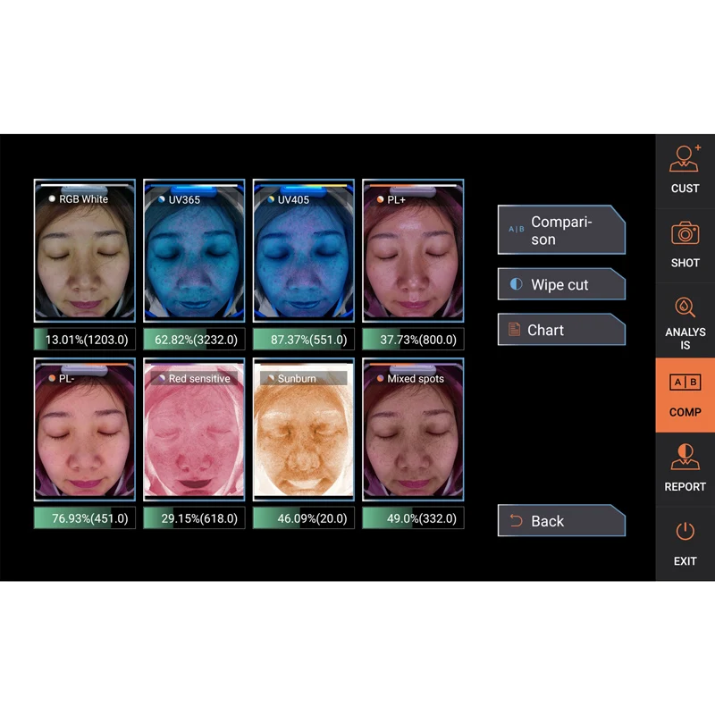 tester  diagnosis hair digital  type pigment volume 15 mp 10 care camera wireless wifi skin scalp analyzer