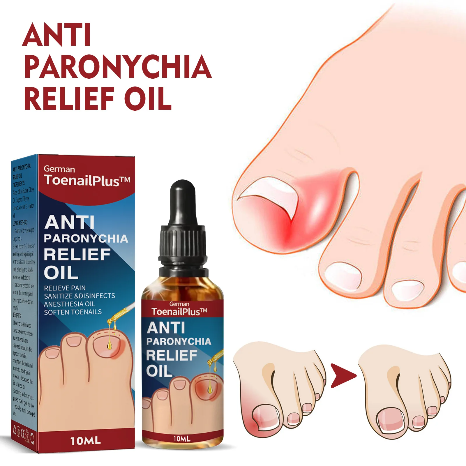 Nail Renewal Extra Strength Fungus Toe Fingernails Repair Liquid Renew Damaged Broken Nail 7 Days Nail Fungus Treatment
