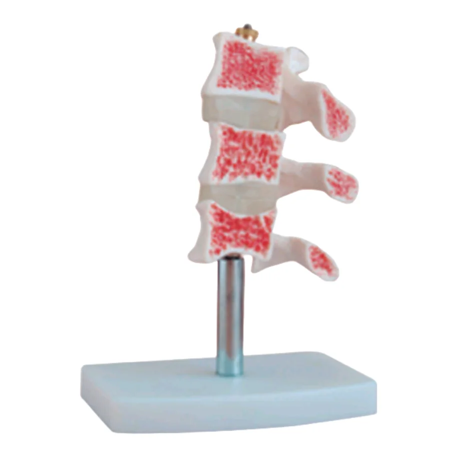 BIX-A1022 PVC Life-Size Human Anatomical Skeleton Osteoporosis Models for Medical School Training