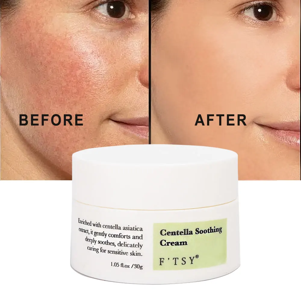 2024 Asian Centella Moisturizing Hydrating Antioxidizing Repairing Claming Day And Night Face Cream