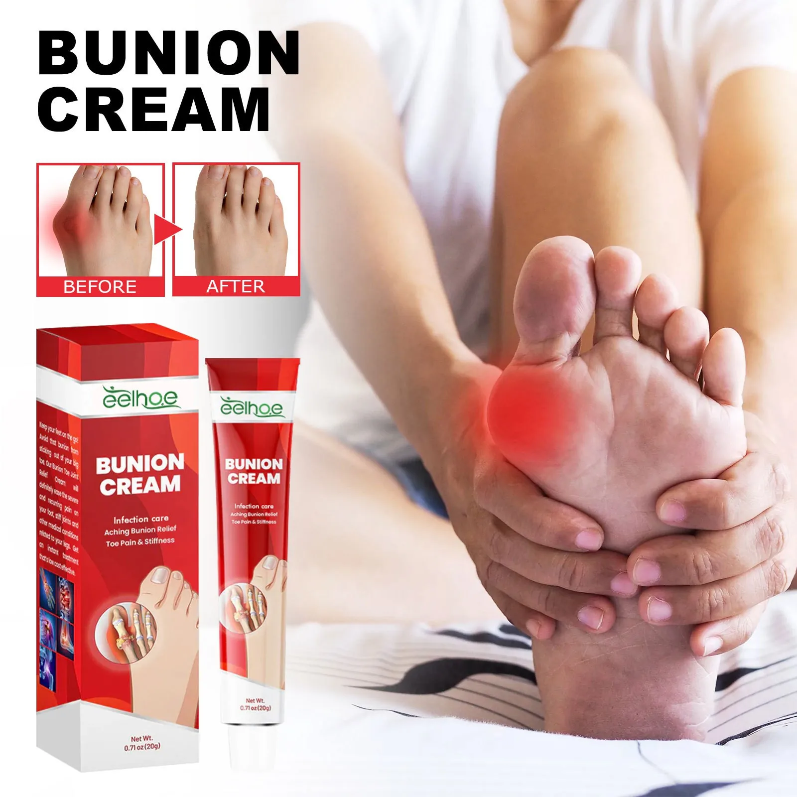 EELHOE High Quality Vegan Ingredients Infection Care Aching Bunion Relief Toe Pain Stiffness Bunion Cream