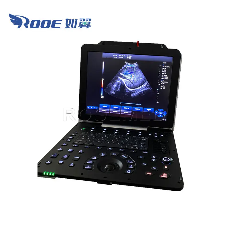 USC300PRO Medical Portable Scan Cardiac Color Doppler Ultrasound