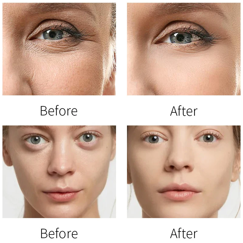 Anti Ageing Cream with Collagen Anti Wrinkle Reduce Appearance of Dark Circles Fine Lines Retinol Face Cream