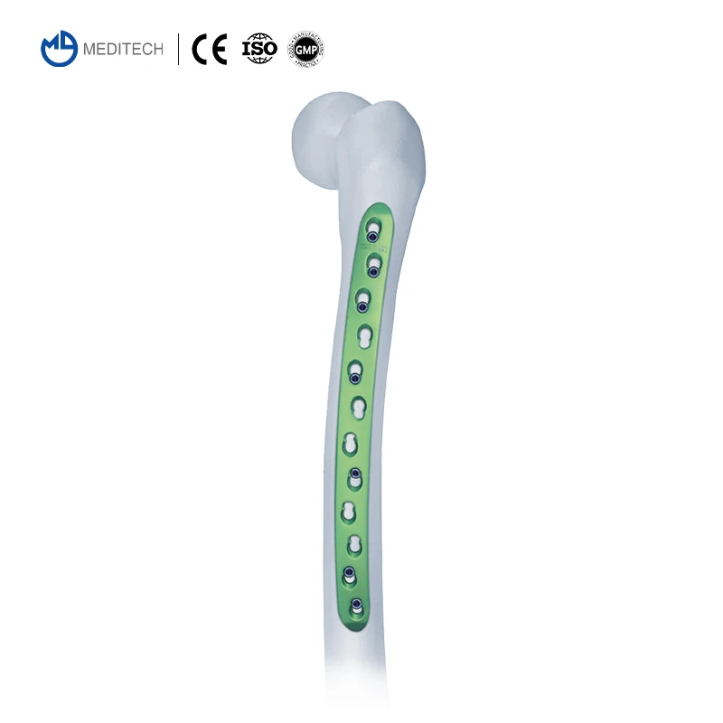 Orthopedic Implants Surgical Screws And Plates LCP Titanium Femur Locking Compression Plate