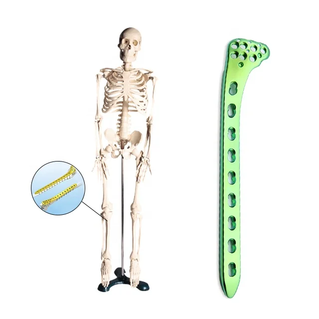 Tibial Proximal Lateral Locking Plates Orthopedic Locking Plates Orthopedic Implants Trauma Plates bone implant