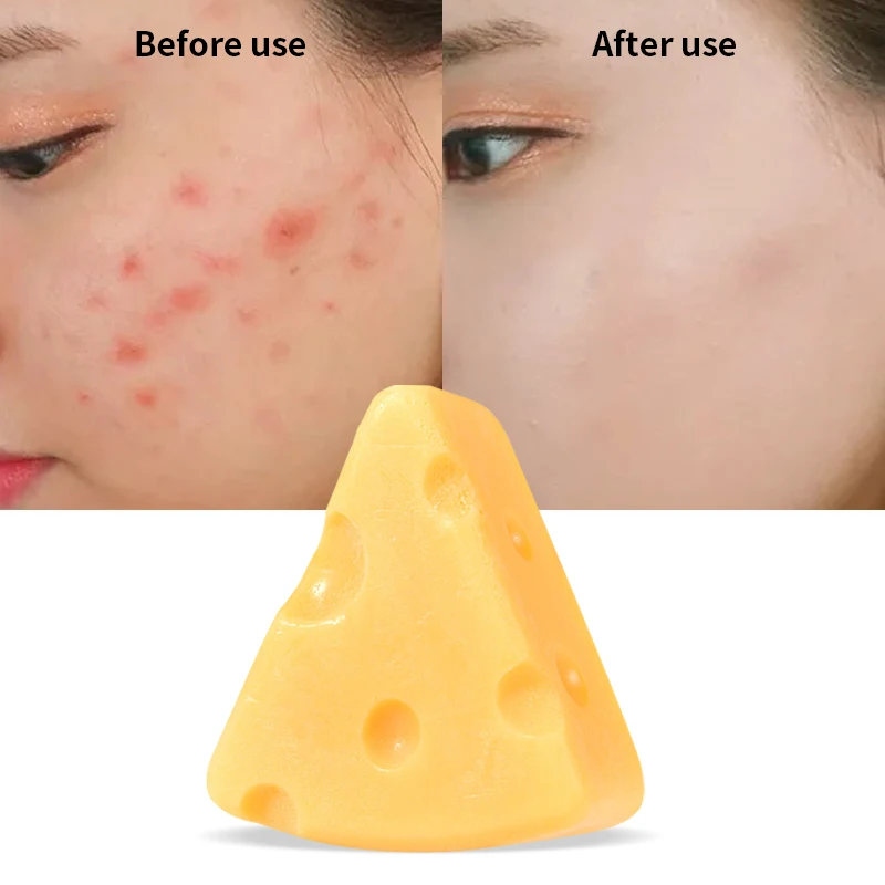 OEM ODM Private Label Face Control Oil Deep Cleansing Rich in Vitamin C Keep Skin Softening Cheese Soap