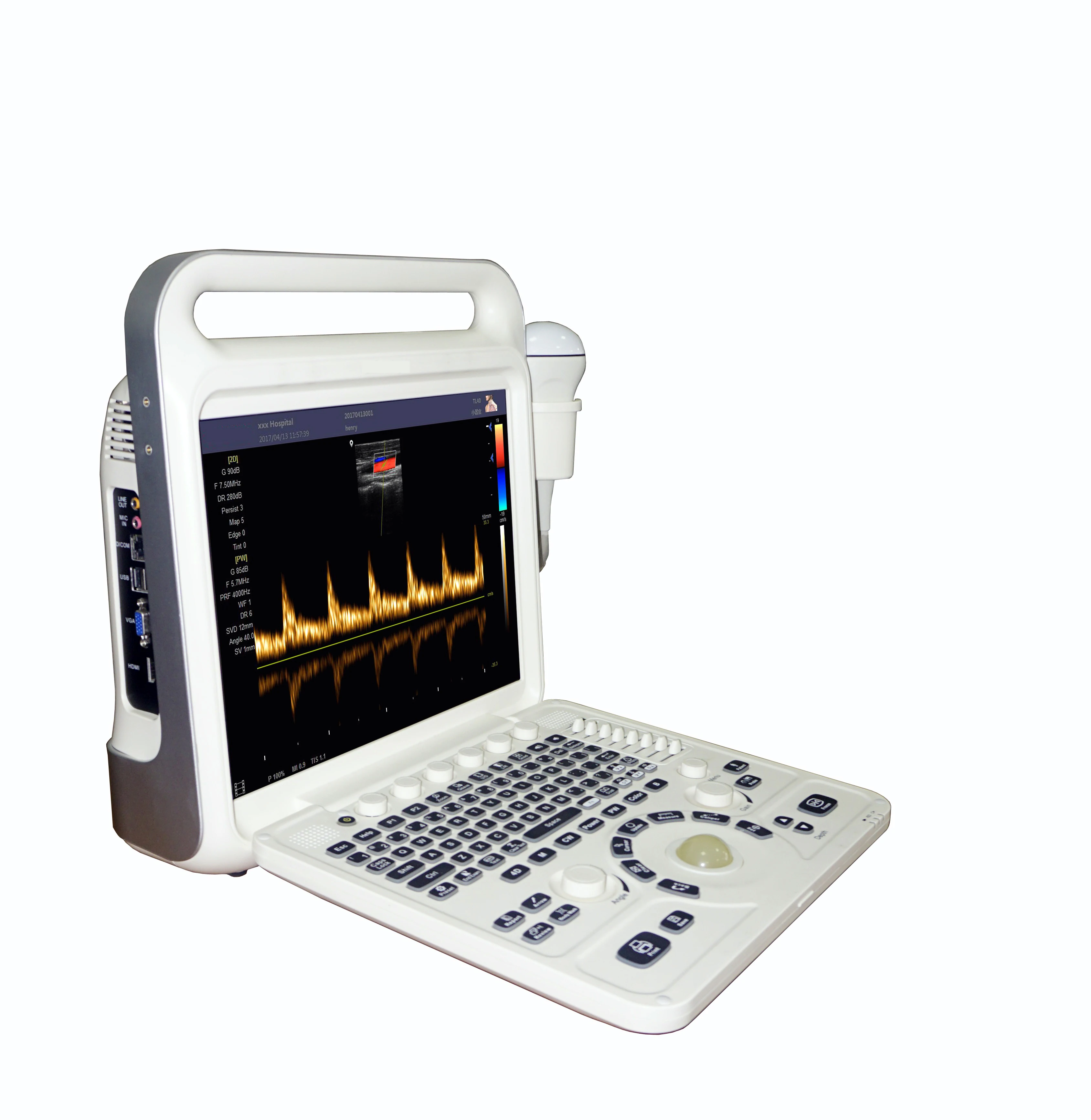 Portable Full-Digital Ultrasound Machine with Electric Power Source Medical Plastic Portable Ultrasound Scan