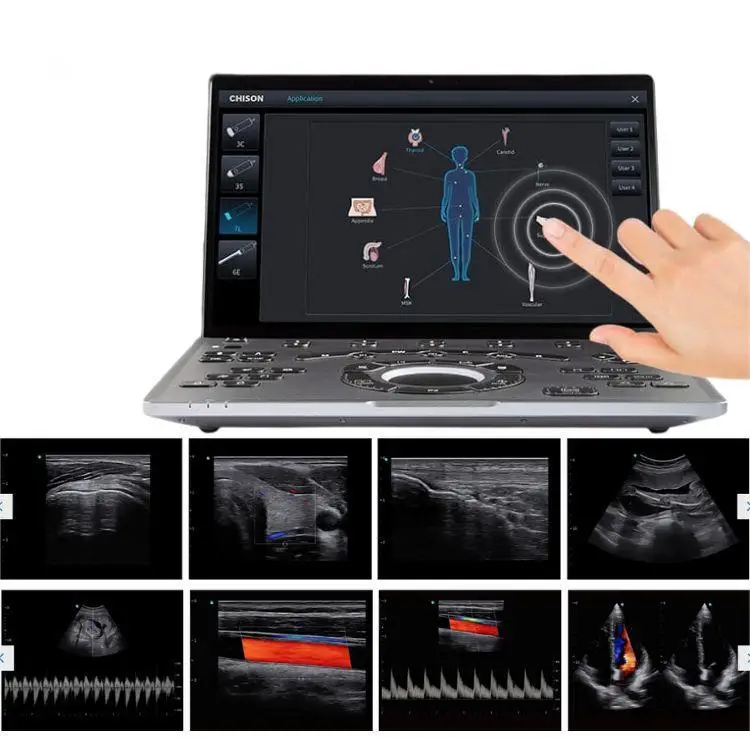 Portable Chison Ultrasound machine Sonoair 70 Ultrasound  3d 4d scanner color doppler Ultrasound System use for PT  MSK Vascular