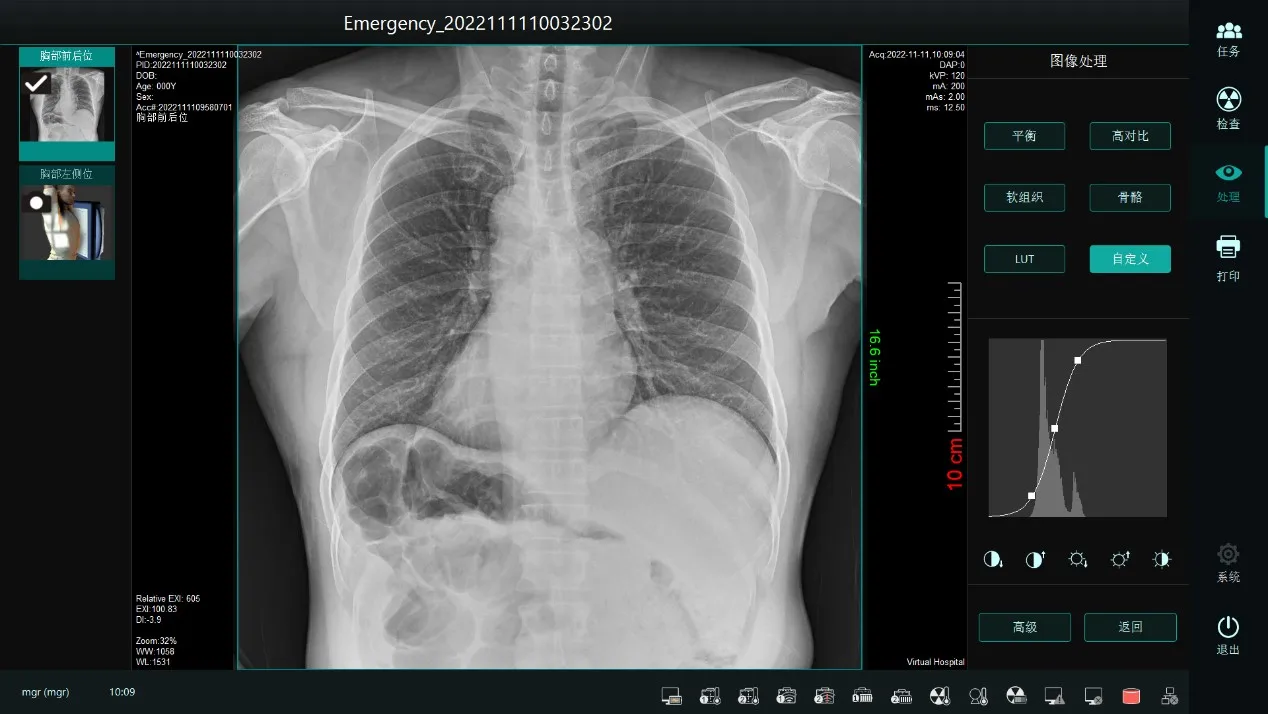 Affordable 14*17/17*17 rx portatil x-ray machine digital x-ray flat panel detector x-ray