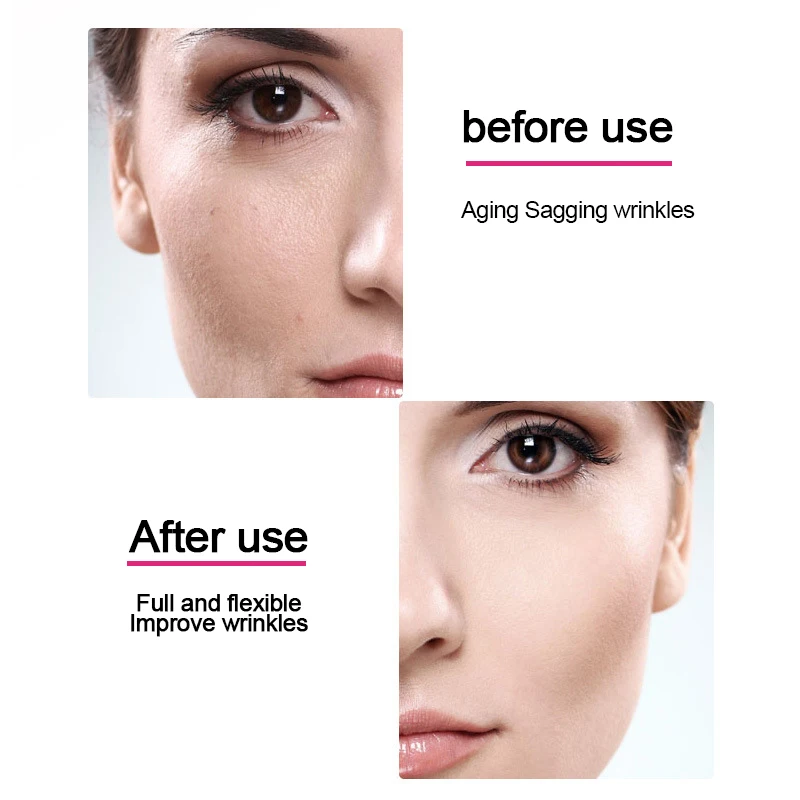 probiotics relief sheet mask Private Label OEM ODM Custom Logo skincare Korean Cosmetics wholesale skin care Facial mask