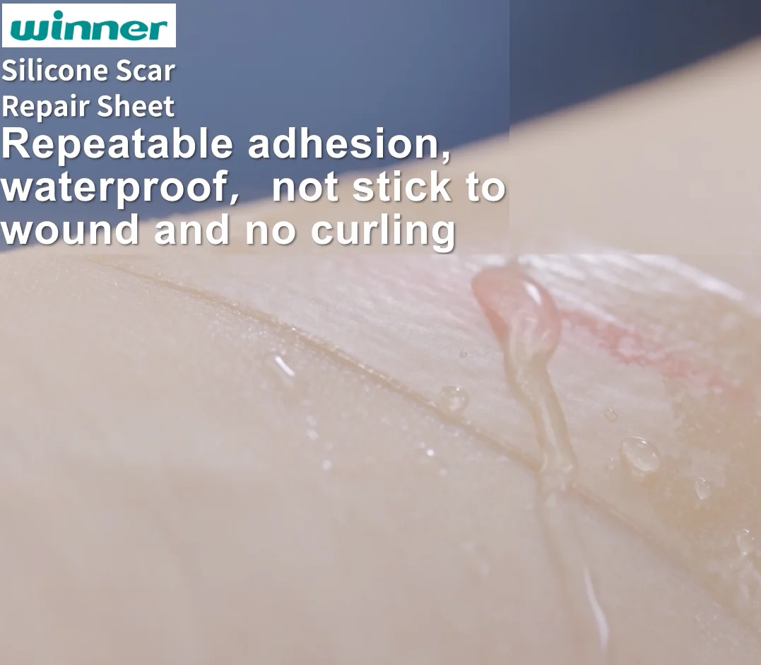 Self-adhesive scar Away winner Silicone scar Gel Sheet Remove Striae burns Surgical silicone scar removal sheets