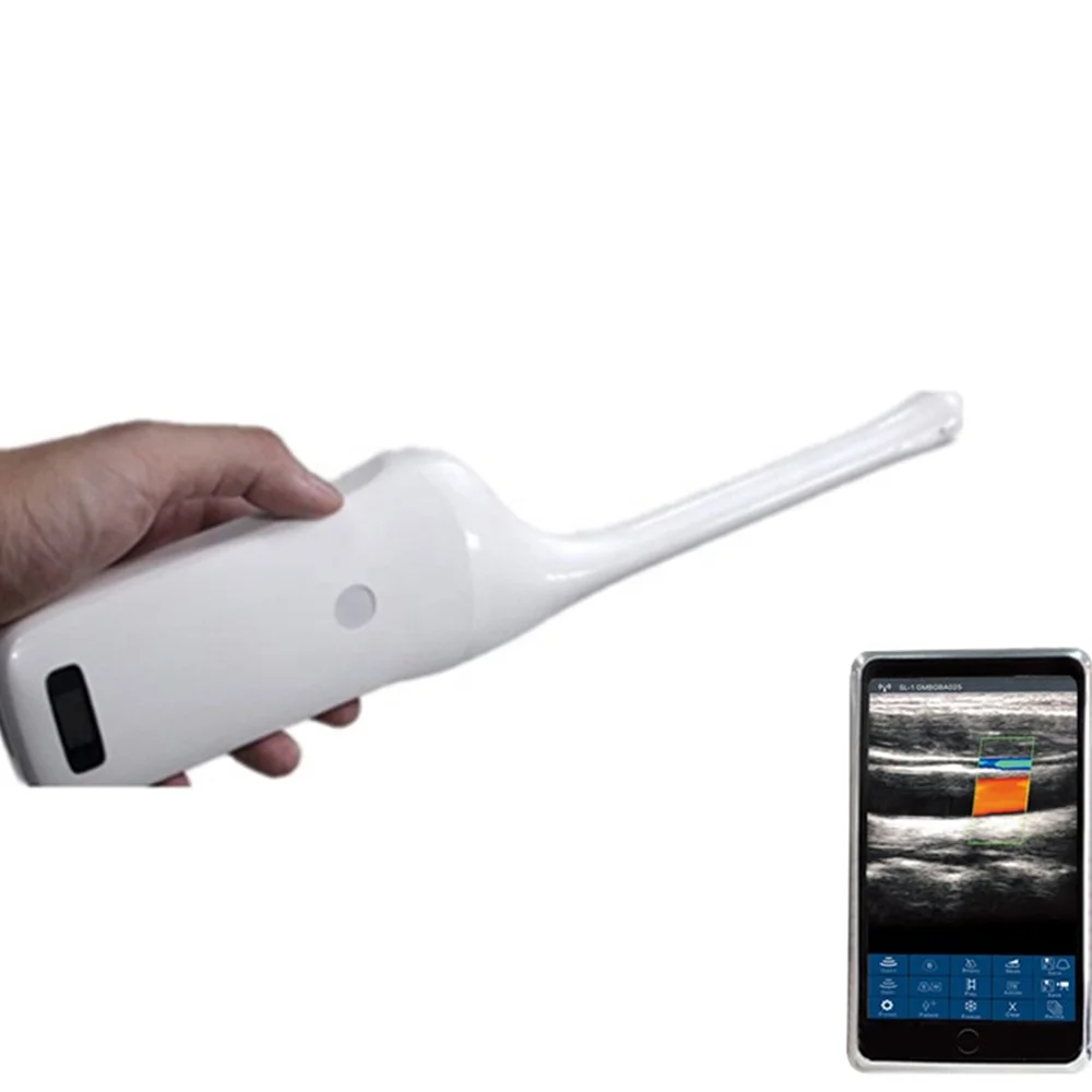 Clarius Transvaginal 192 Elements Wireless Color Doppler Ultrasound Double Head 6.5/8 MHz HD Image Quality