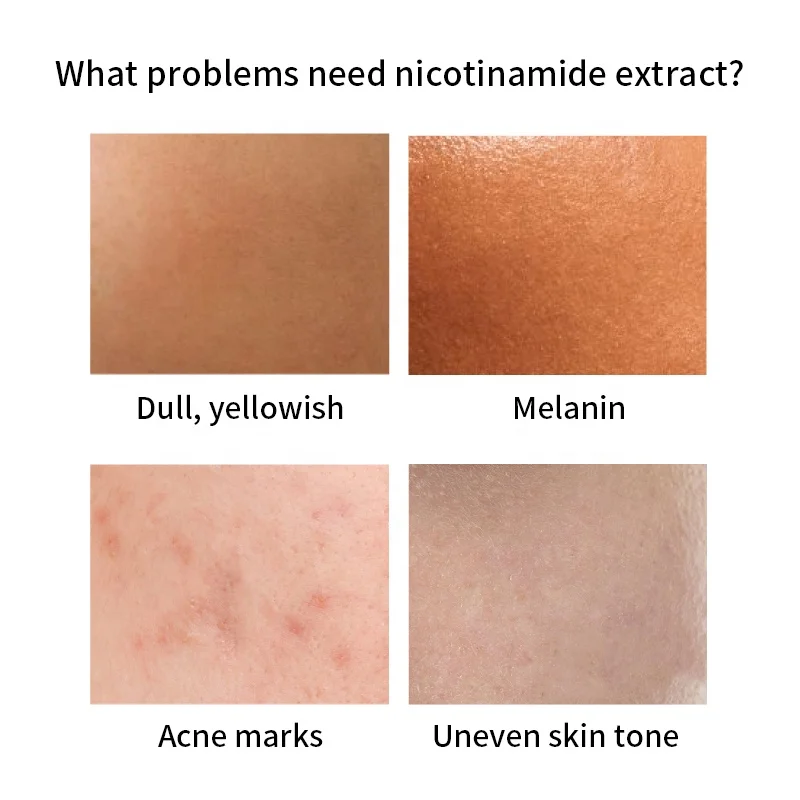 Wholesales 30ml Skin Care Whitening Anti-wrinkle Anti-acne 10% Niacinamide B3 Face Serum