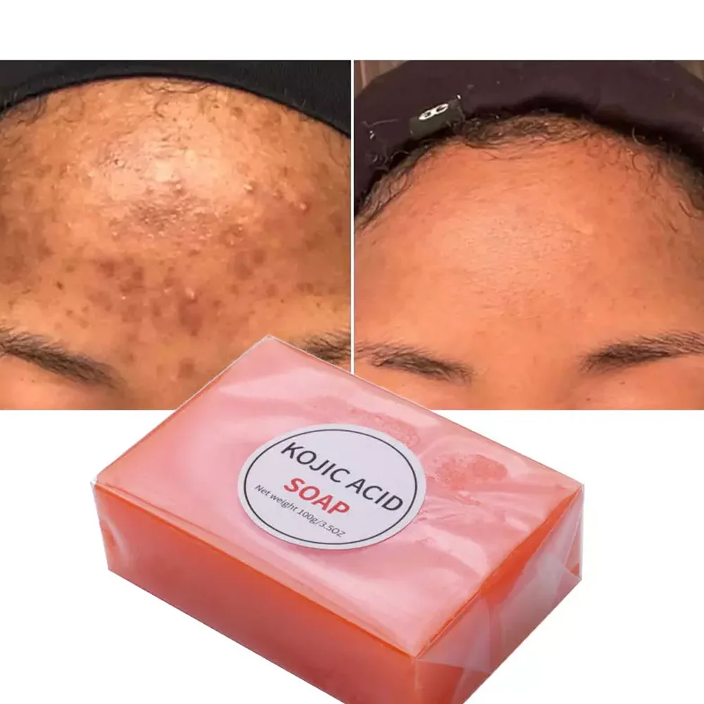 100%, Natural Organic Turmeric Kojic Acid Soap Bar Manufacturers Tumeric Handmade Soap For Whitening Soap