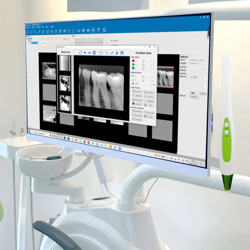 Factory Price Size1.3 Dental RVG Sensor For Dental X-Ray