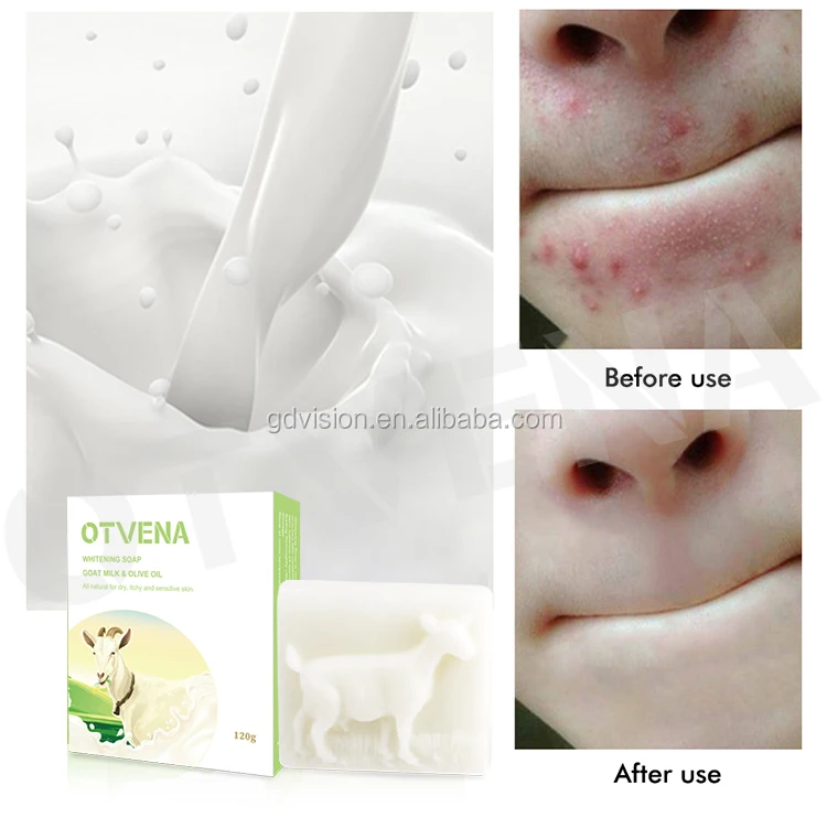 Private Label Skin Lightening Acne Removing Natural Handmade Goat Milk Soap