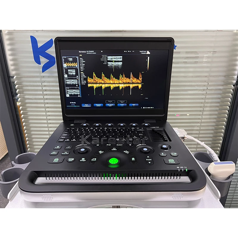 K-H101W Portable color pet CW PW ultrasound machine for animal hospital VET portable ultrasound