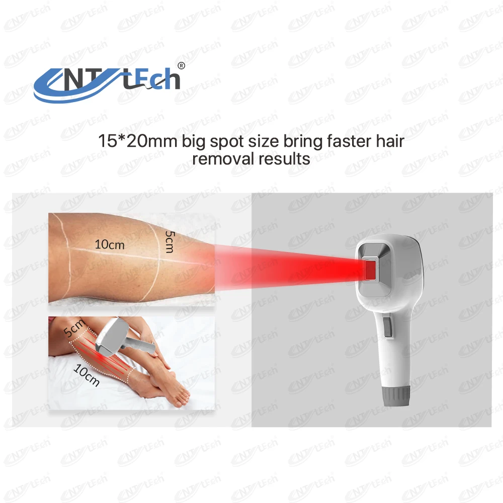 Beijing unt android system 800w 808nm diode laser hair removal machine with skin analyzer