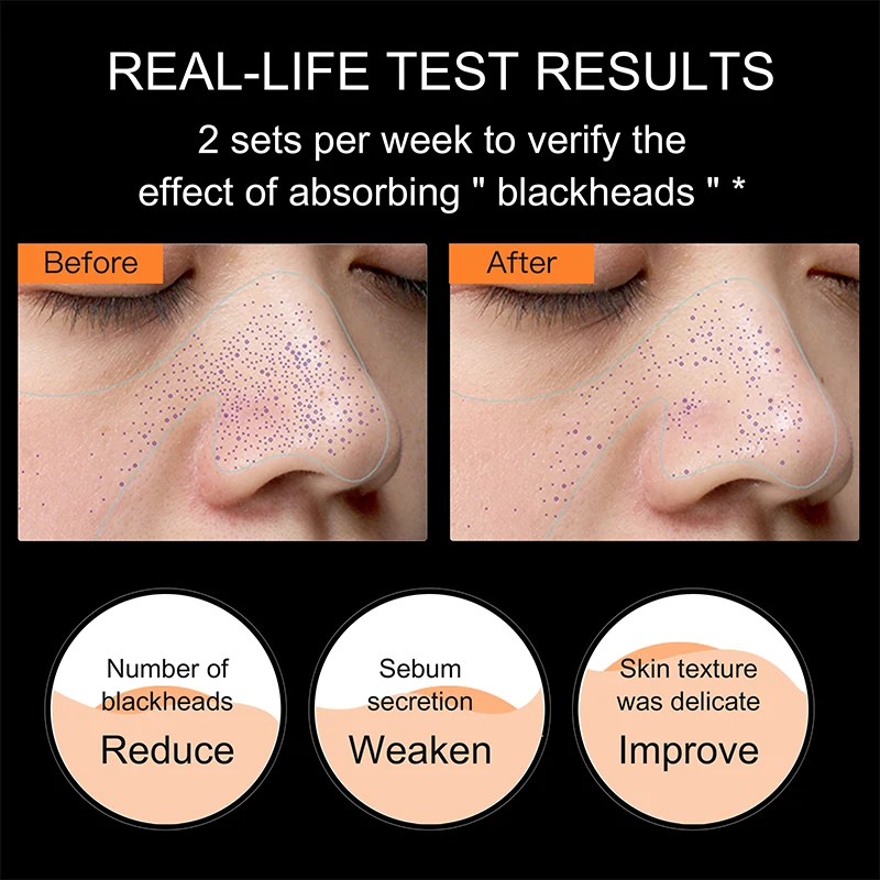 Factory Wholesale OEM ODM Mineral Volcanic Mud Mask Blackhead Remover For Face