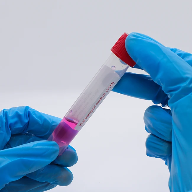 OEM/ODM Transport Medium Sample Disposable Saliva Collection Mouth Bucca Swabs Sterile Nasopharyngeal Oral Nasal Swab Stick