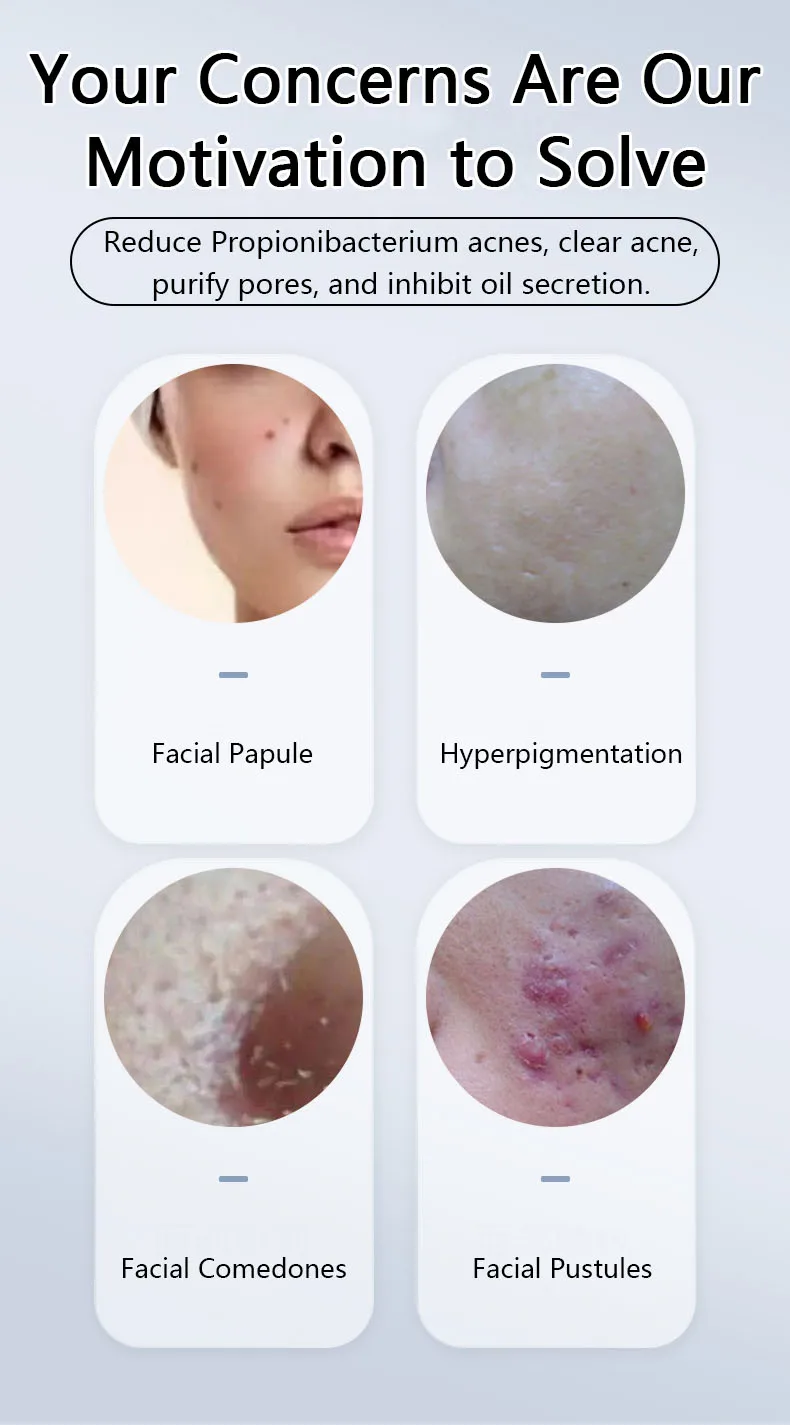 Hydrocolloid Acne Stickers Pimple Healing Master Patch Micro Needle Salicylic Removal Acne Pimple Patch Microneedle Custom