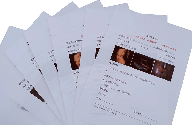 Ultrasound Imaging Output White Medical X-Ray Film Single Side Inkjet Medical Film