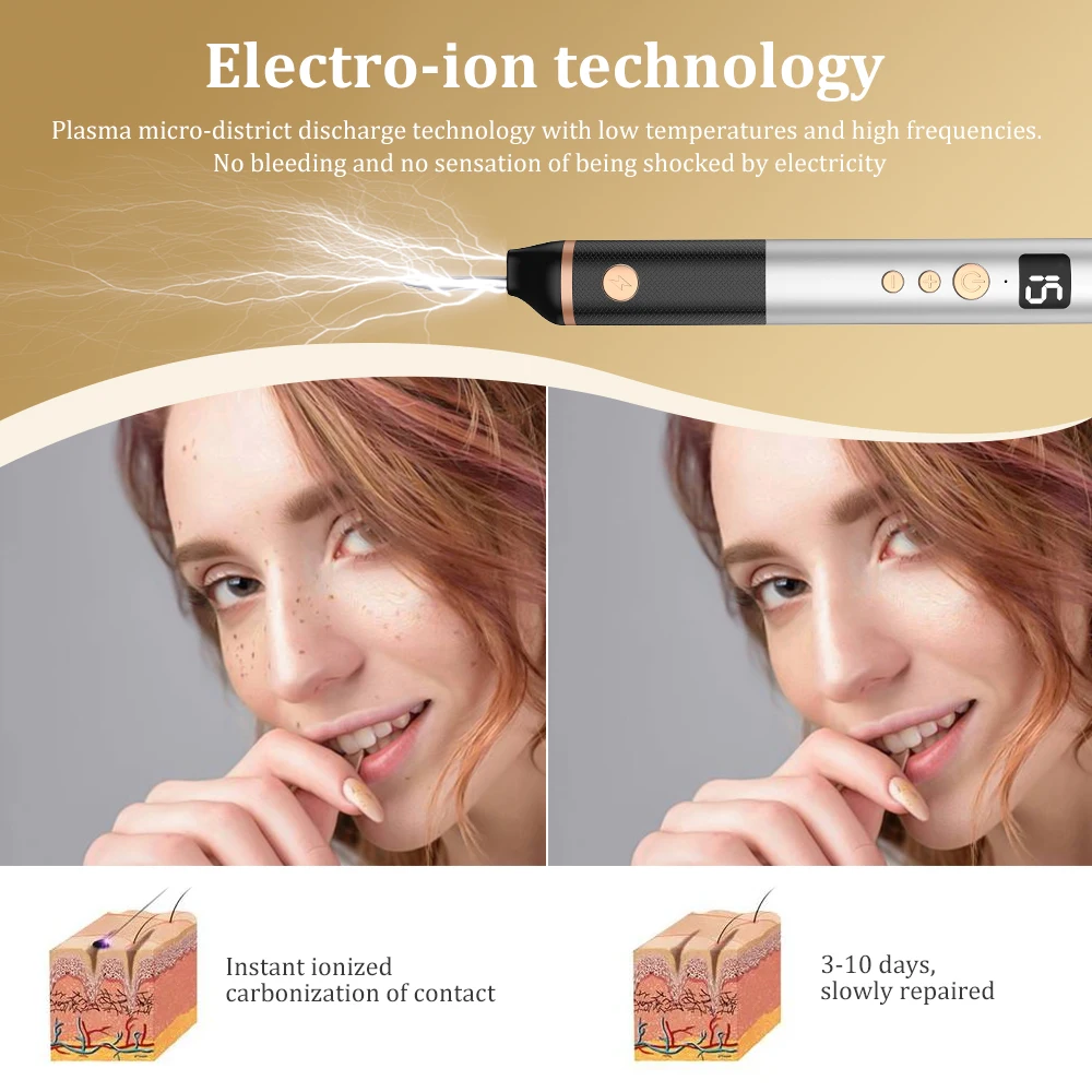 Trends Plasma pen Facial Tag Removal painless Plasma Pen Cauterizer Removing Electrocautery Wart Papilloma Skin Eraser Mole Pen