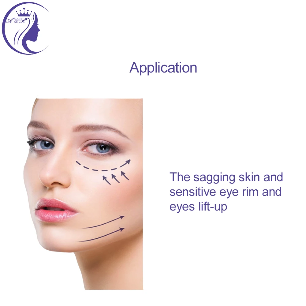 eye thread 30G 38mm fashion thread lift face lift therapy and face thread lifting for deep wrinkle with ce