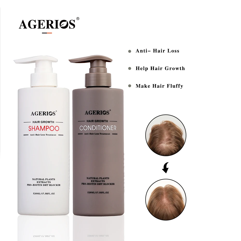 Private Label Gentle Cleansing Shampoo And Conditioner Care Set Dandruff Hair Loss Natural Organic Hair Growth Ginger Shampoo