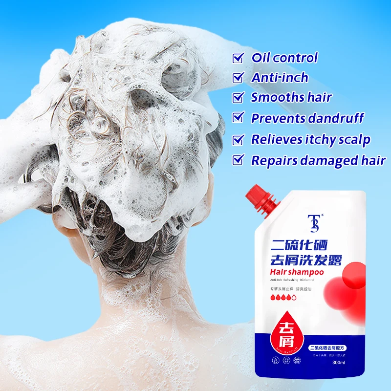 Anti Dandruff Shampoo for Dry, Itchy Scalp Dryness and Itch Relief Dry Scalp Treatment