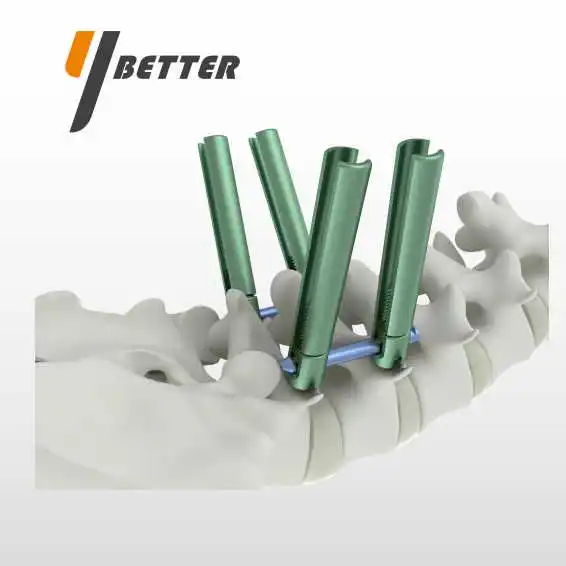MIS Minimally Invasive Spine System-Polyaxial Screw Orthopaedic Implants Manufacturers  Factory
