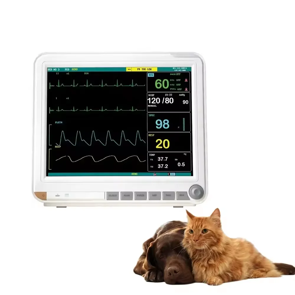 Super Quality With Etco2 Sensor Monitors With Patient Monitor Stand Optional Multiparameter Monitors
