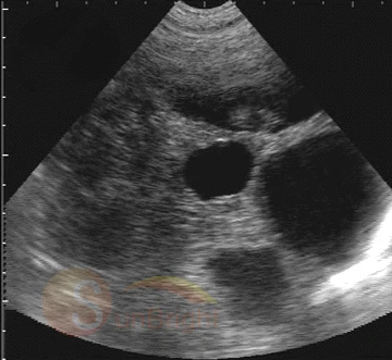 Portable Laptop vet ultrasound scanner equipment For Pet Animal Full Digital Cheapest Laptop veterinary ultrasound