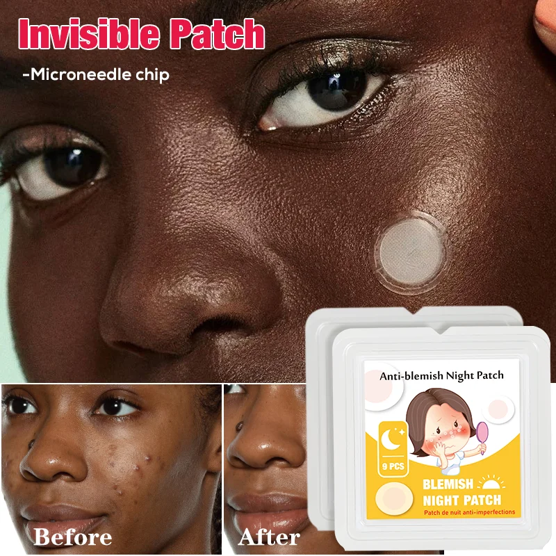 Private Label Rapairing Tea Tree Micro Needle Acne Patch Skincare Acne Treatment Spot Blemish Remover Patches Acne Patch