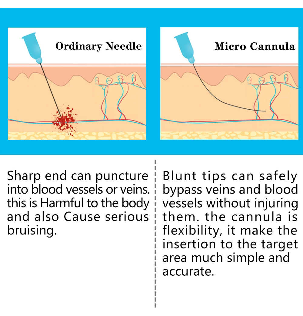 High Quality Precision 23G 38mm 50mm 70mm Ultra Fine Blunt Tip Sterile For Derm Filler