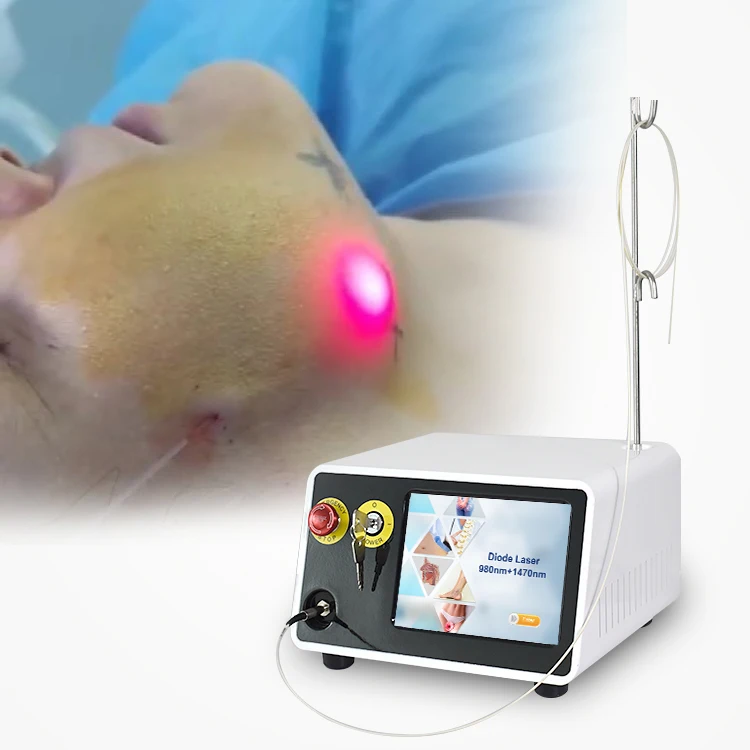 2024 Hot Sell High Quality Powerful Facial 980nm 1470nm Diode Laser Liposuction Machine
