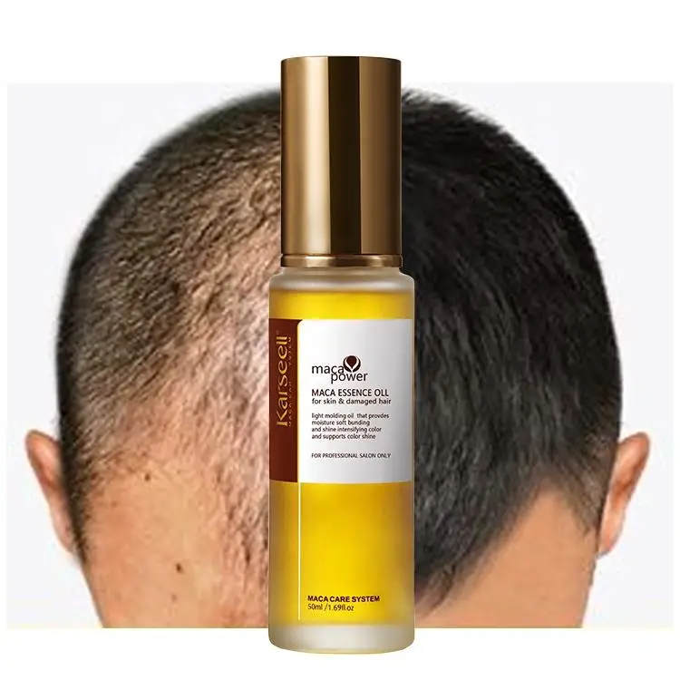 Karseell Essential Oil Hair Growth Hair Loss Treatment Care Hair Growth Serum for Men & Women 50ML
