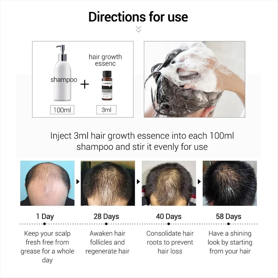 LANBENA Fast Powerful Hair Growth Products Oil Preventing Hair Loss Hair Care Andrea