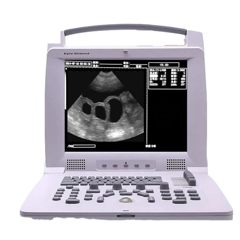 High quality portable ultrasound scanner for vet veterinary ultrasound scanner portable equine ultrasound scanner
