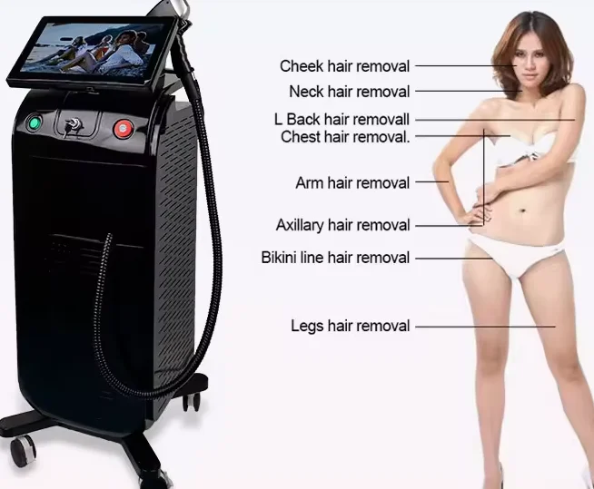 laser hair removal machine for men commercial laser hair removal machine price