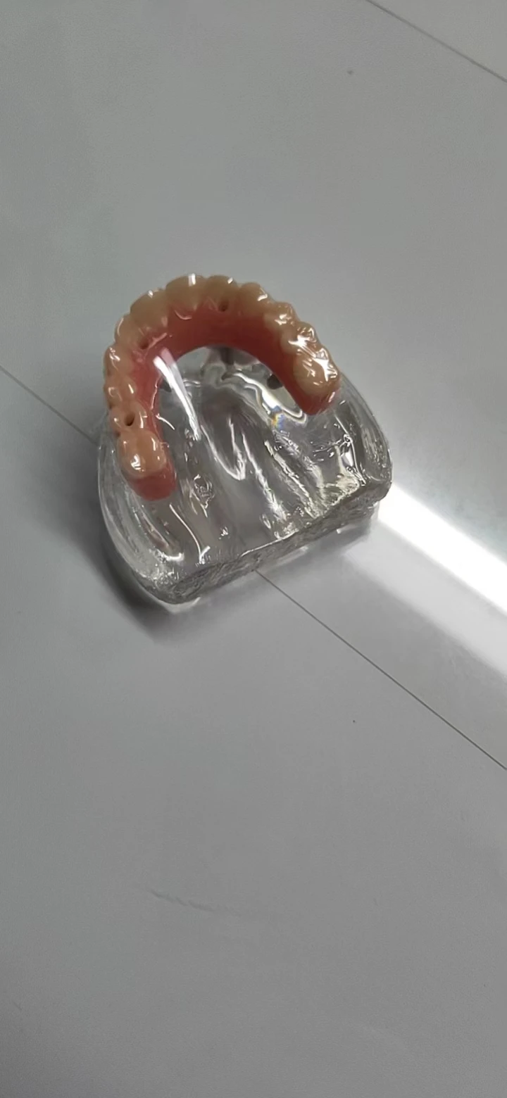 All on 4 speedy model  ALL-ON -4 implant model