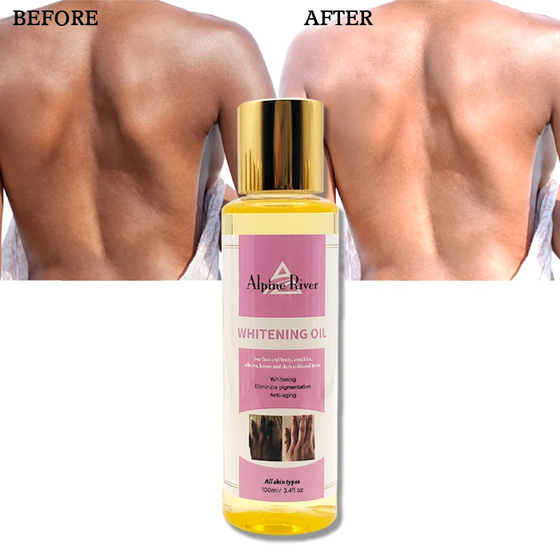 Private Label Alpine River 100% Natural Organic Vitamin C Knuckle Whitening Papaya Skin Care Oil For All Skin Types