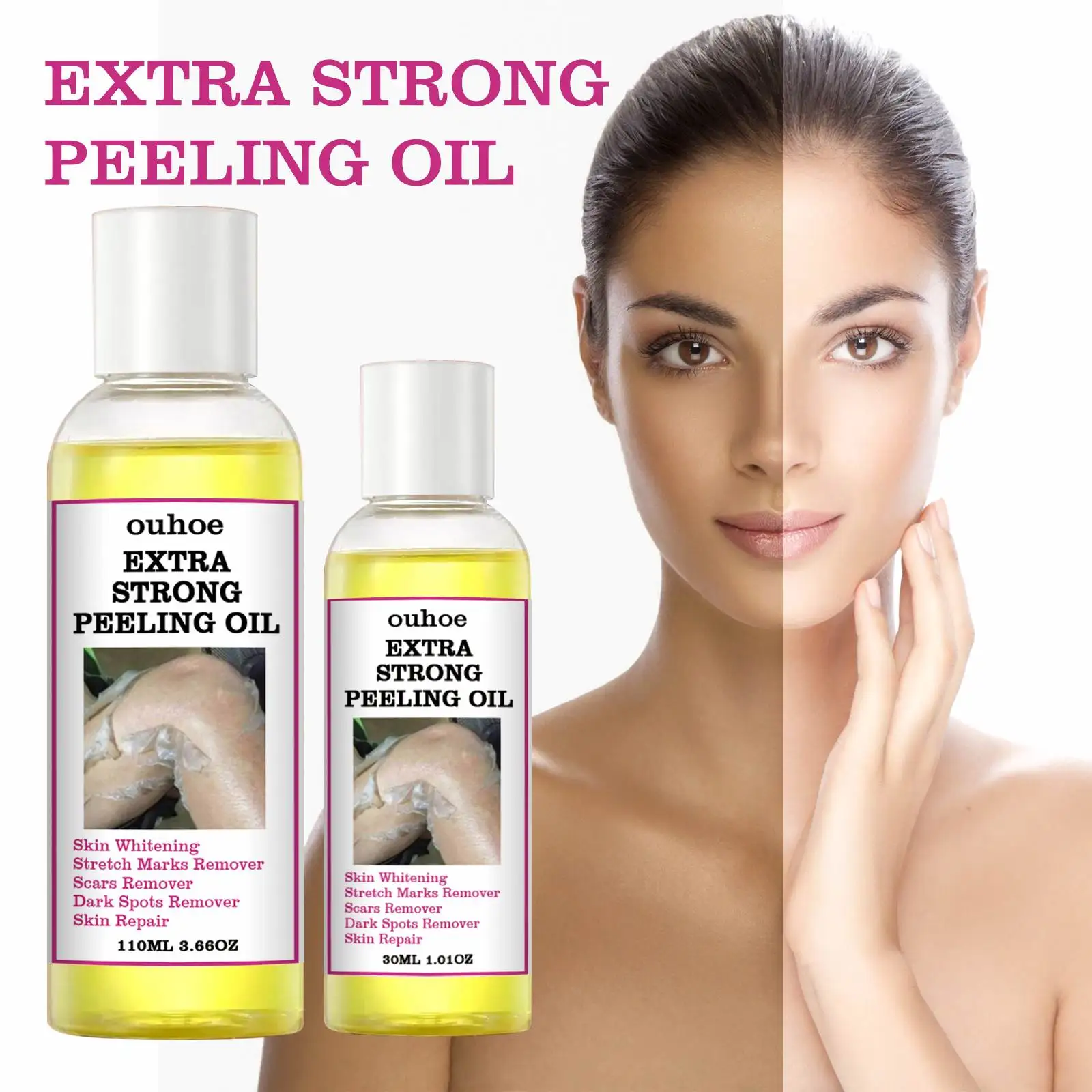Private label Extra Strength Yellow Peeling Oil Elbows Knees Hands Melanin Bleaching Dark Skin Knuckle Whitening Removal Oil