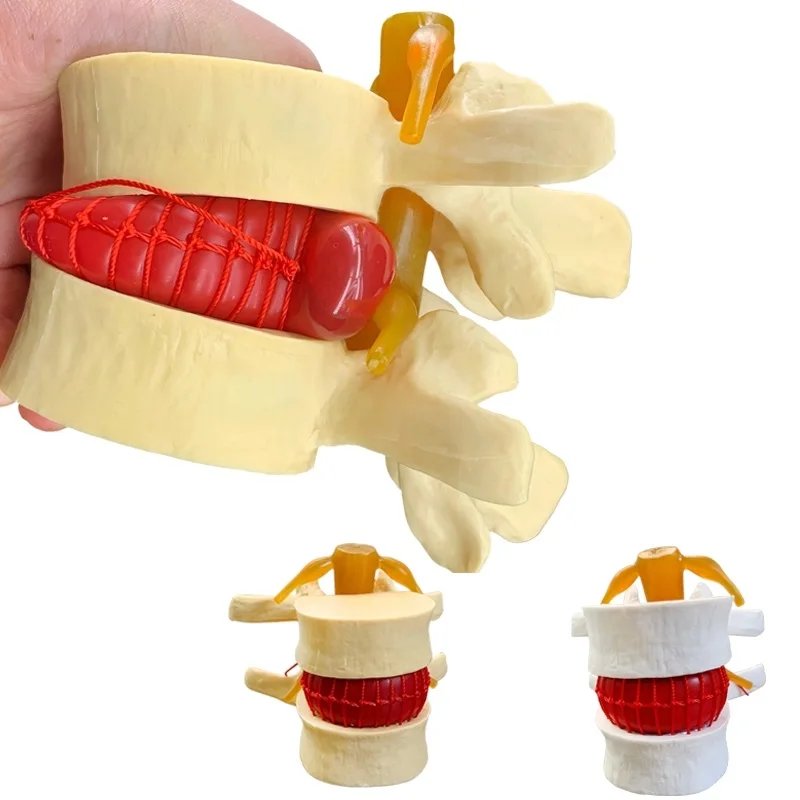 Spine Model Human spine model full size demonstration model of human lumbar intervertebral disc compression for medical teaching