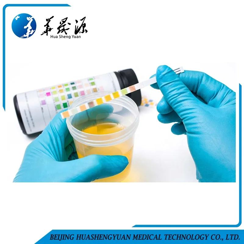 14 parameters urine test strip