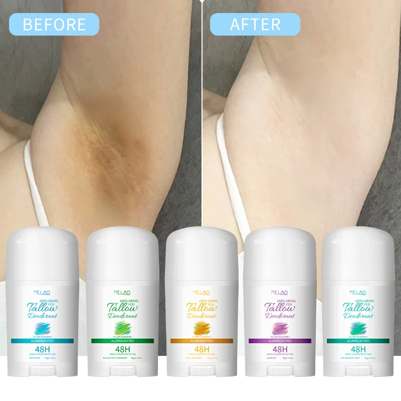 Custom Women Deodorant Long Lasting Underarm Whitening Armpit Deodorant Tallow Roll On Deodorant