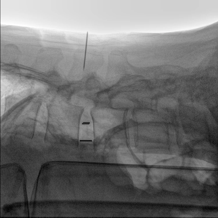 DATA secure Mobile C arm x ray system with built-in power supply