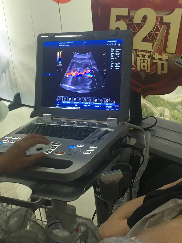 JM-906B laptop ultrasonic machine cheap 3D 4D Color Doppler scanner with battery